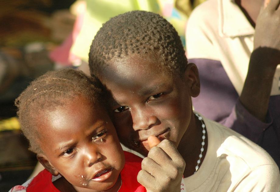 Two Sudanese children sun on face